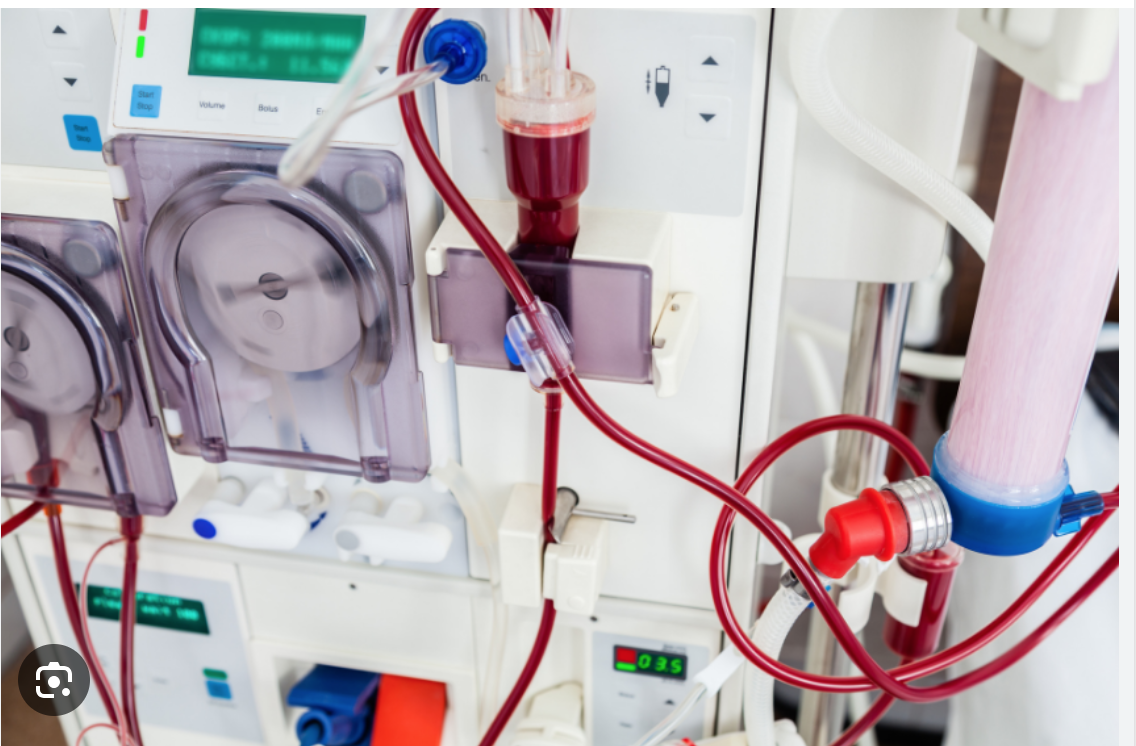 Installation de nouvelles machines de dialyse au CHN et à l’Hôpital de l’Amitié